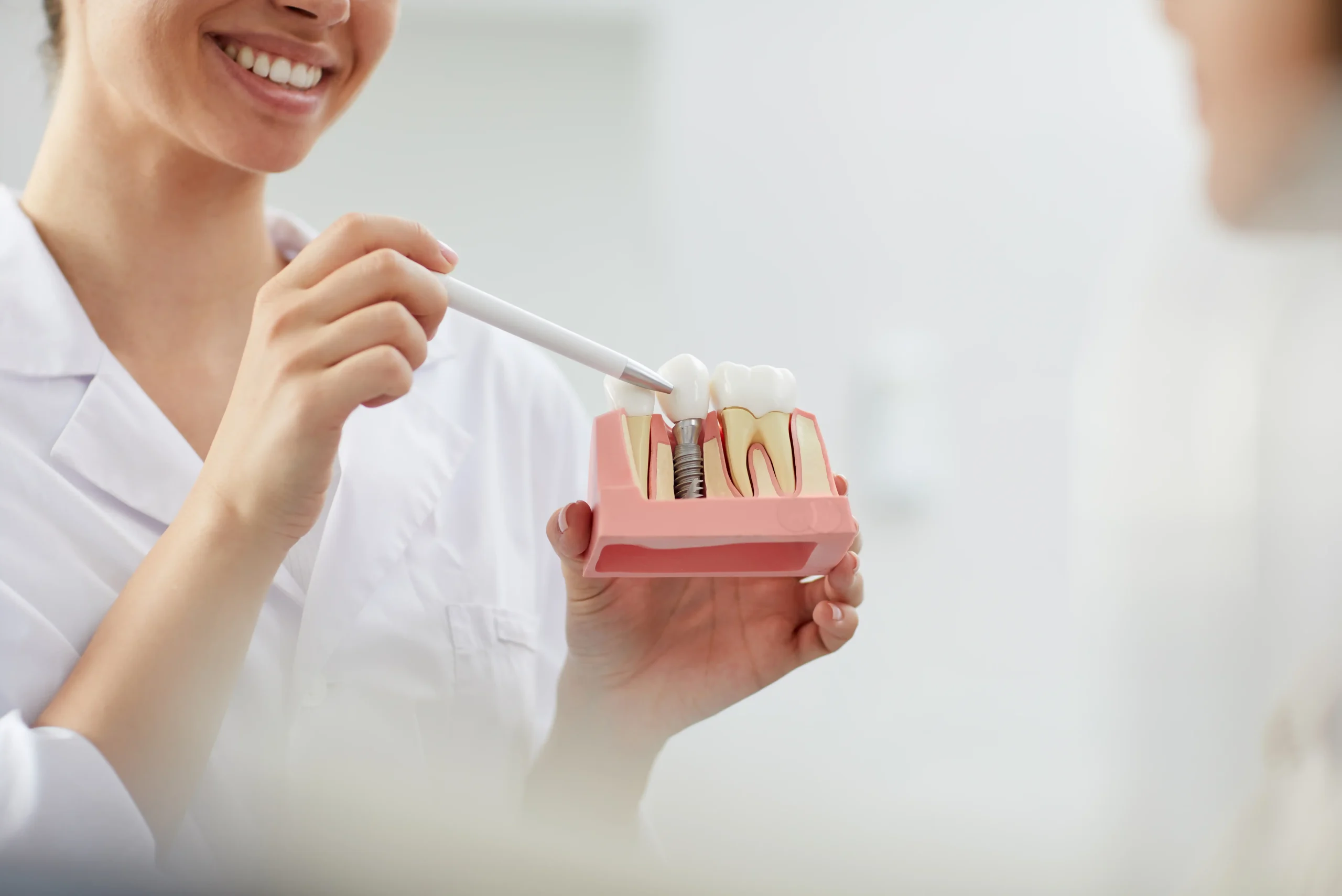 dental implants