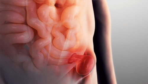 Hernia de Pared Abdominal: ¿Qué Es y Por Qué Requiere Atención Inmediata?